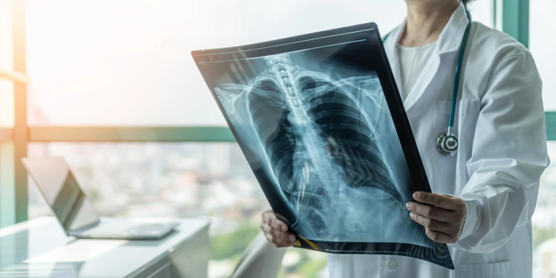 Are Digital X-Rays Safe for Kids? What Parents Need to Know !