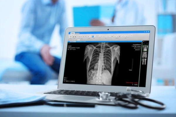 Are Digital X-Rays Safe for Kids? What Parents Need to Know !