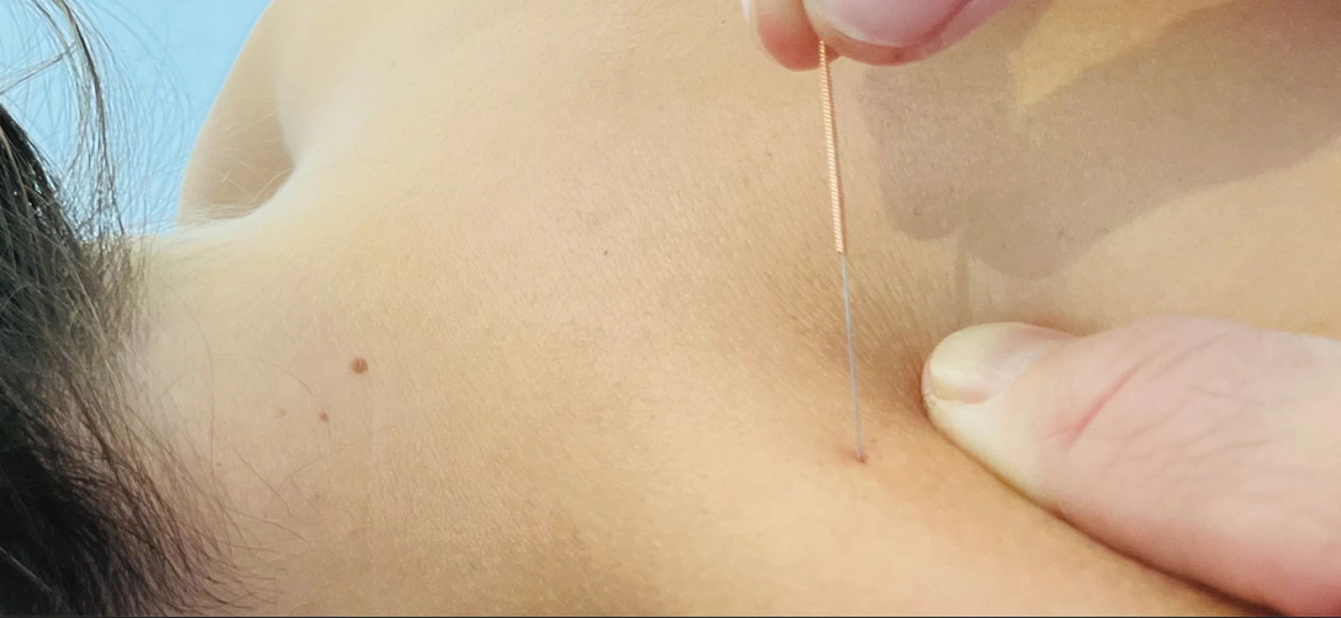 Effective Post-Surgery Physiotherapy & Advanced Tennis Elbow Therapies