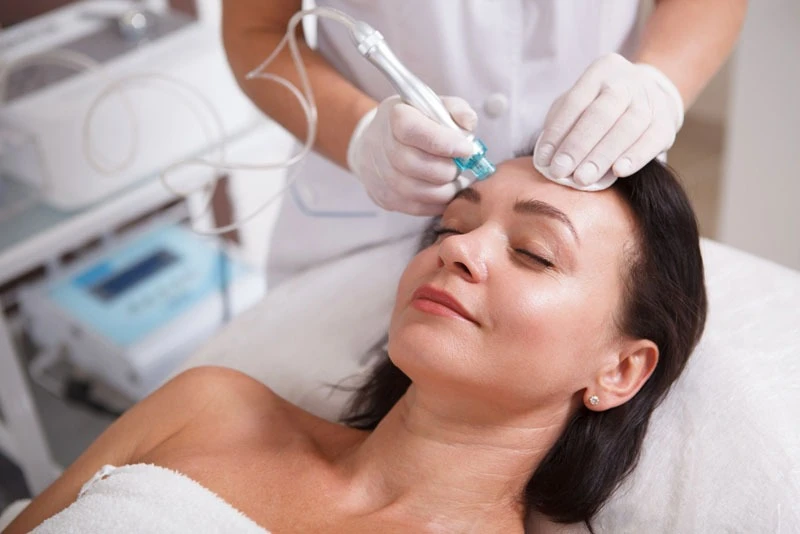 Microneedling Treatment in Delhi: A Dermatologist’s Deep Dive into Skin Renewal
