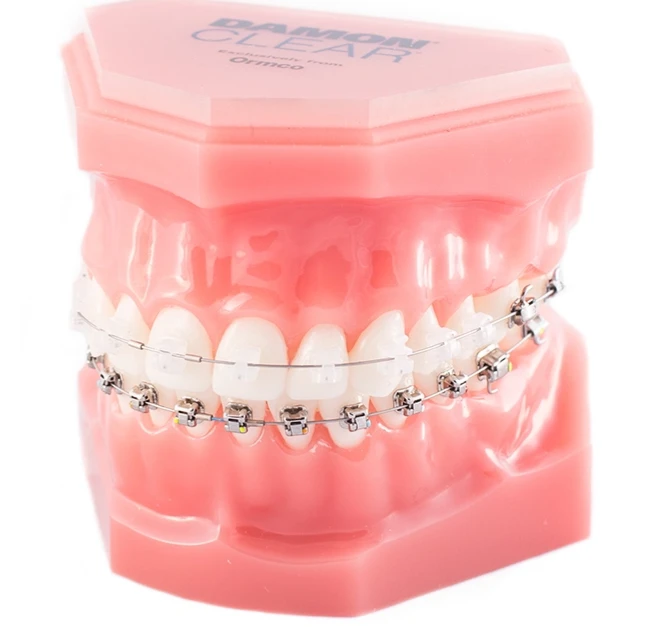Transform Your Smile with Invisalign: Trusted Care from an Expert Orthodontist