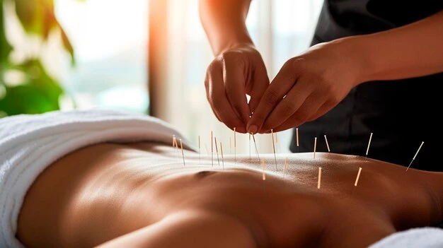 7 Benefits of Acupuncture That Everyone Should Consider