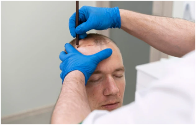 Trust Dr Ditta Hair Transplants for Superb Hair Transplant Solutions
