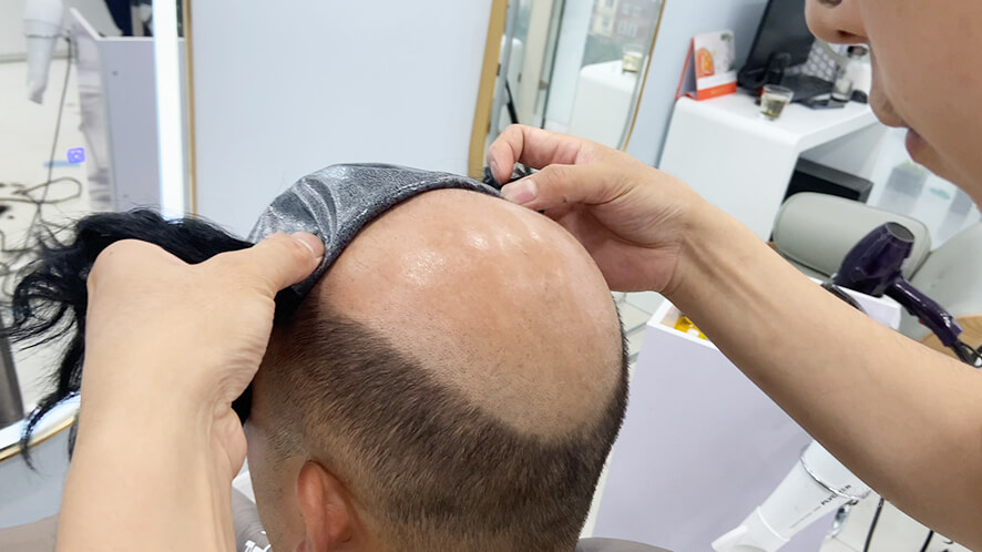 Beyond the Toupee: A Comprehensive Guide to Modern Hair Systems