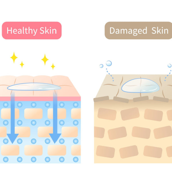 How To Restore Your Skin Barrier | Simple Skincare