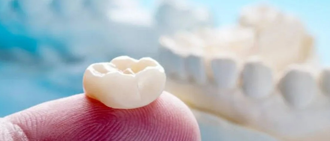 A Clear Patient Guide to Dental Treatment Options and Costs in Gurgaon