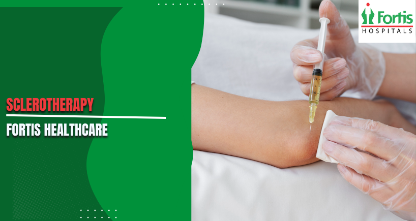 Sclerotherapy for Facial Veins: Aesthetic Benefits & Safety Profile