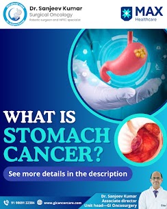 Best Hospital for Stomach Cancer Treatment in Delhi