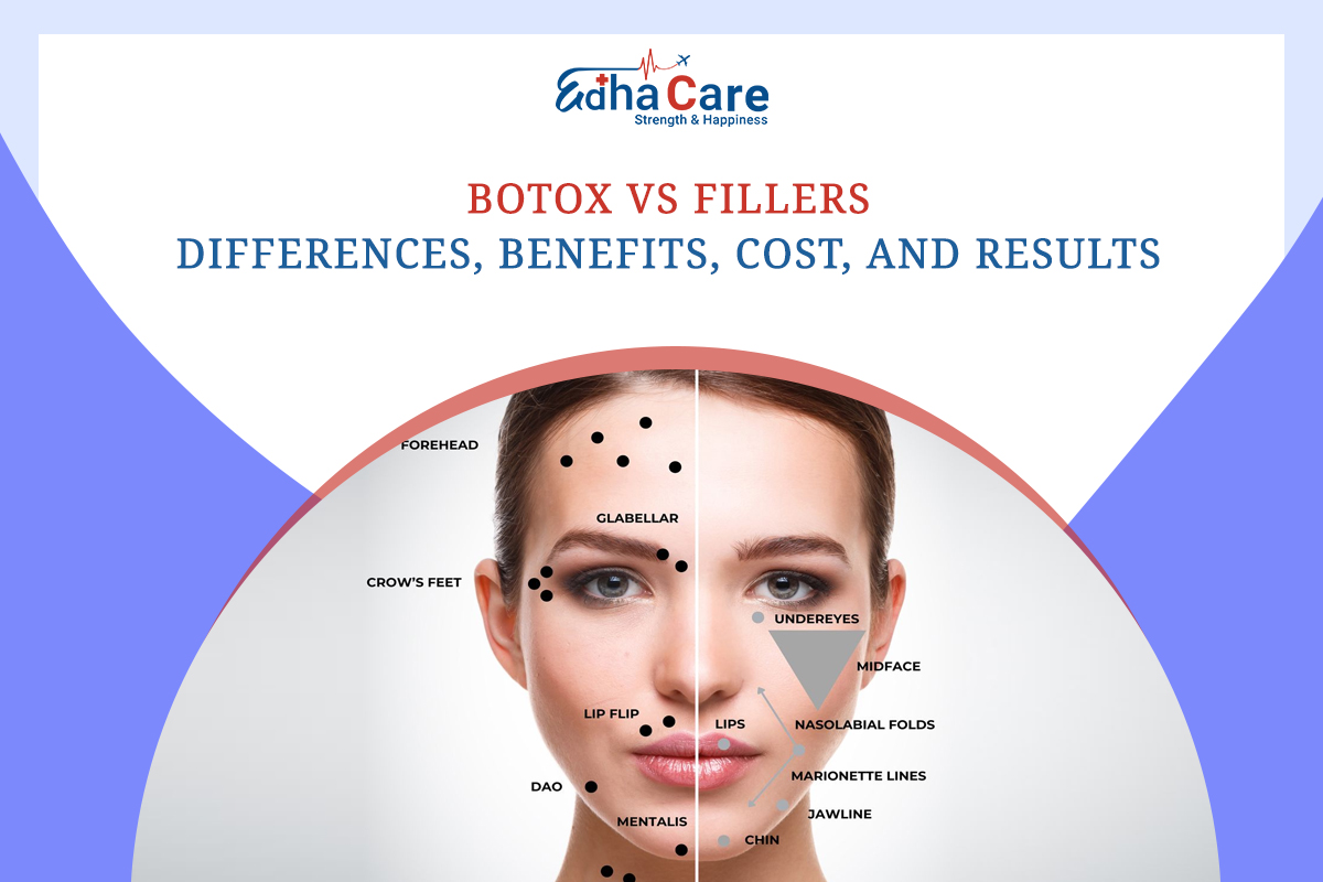 Botox vs Fillers: Differences, Benefits, Cost, and Results