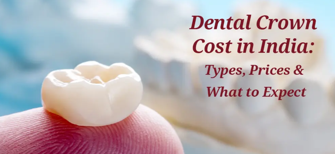 Cost of Dental Crowns in India – A Complete Guide