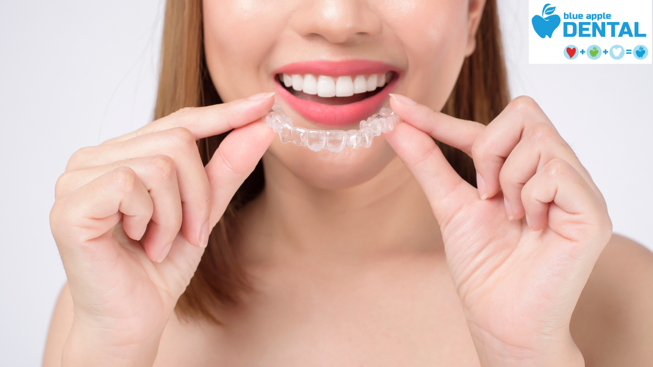 Invisalign