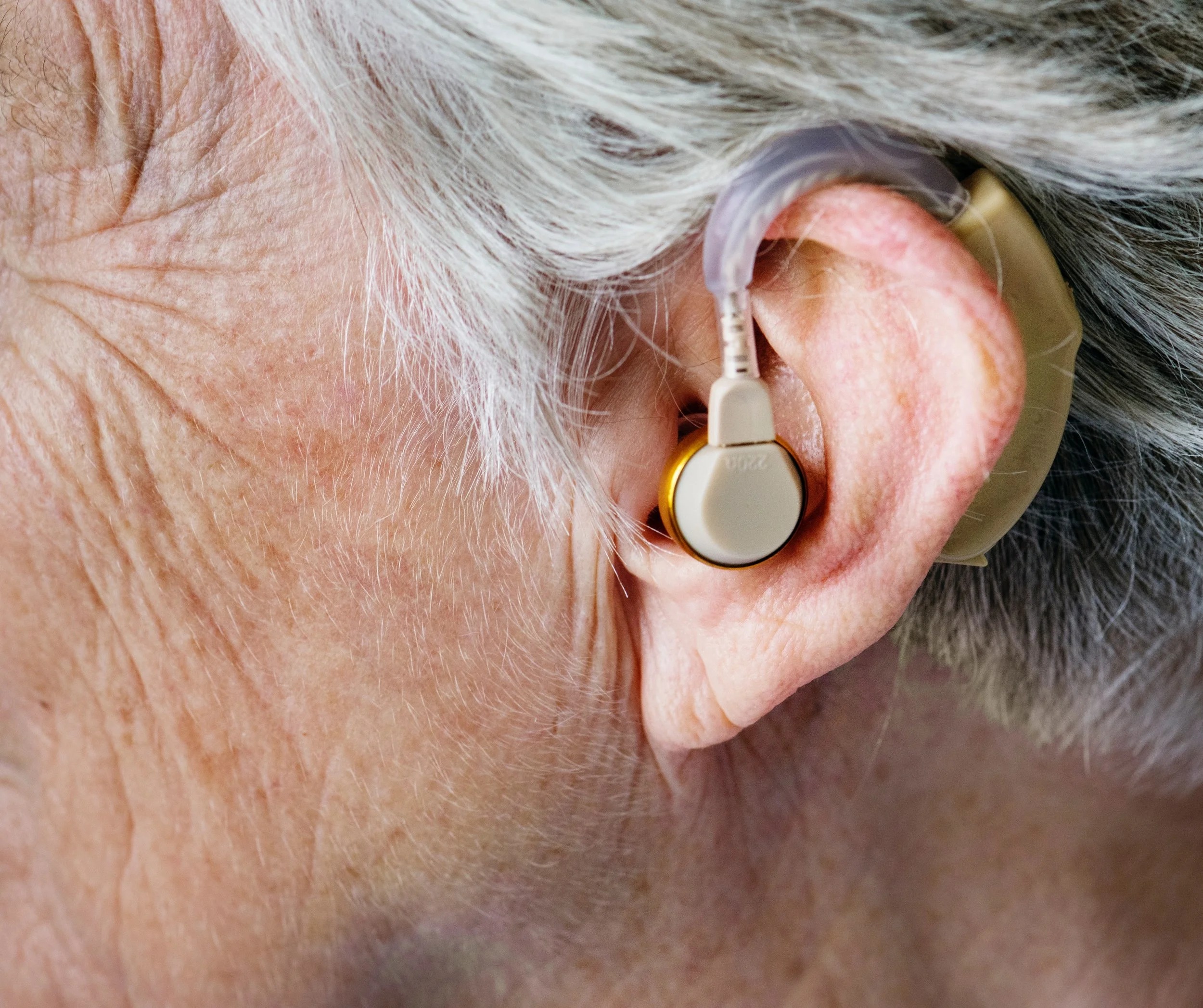 Best Hearing Aids in Kerala: Features, Costs & Expert Advice