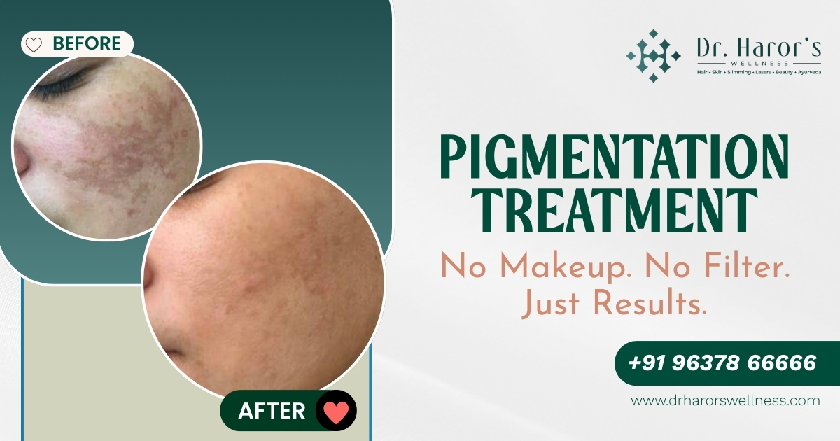 Pigmentation Getting Worse? Best Skin Care Specialist in Delhi Explains