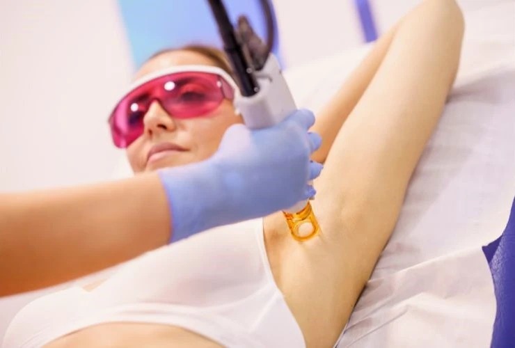 Laser Hair Removal Houston: A Complete Guide to Smooth, Hair-Free Skin