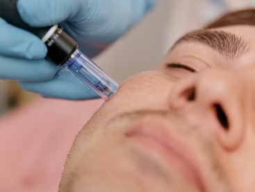 Treatment of Brain Fog in Los Angeles and its suburbs