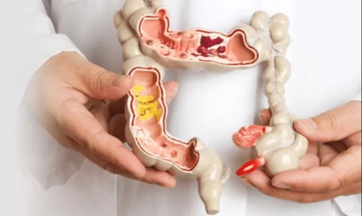 Colorectal Surgeon in Bangalore: Advanced Care with Dr. Bhushan Chittawadagi
