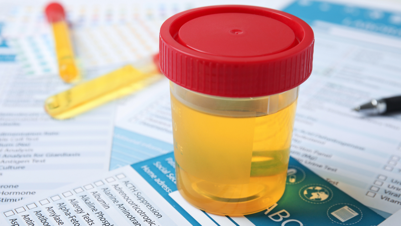 Urine Drug Test