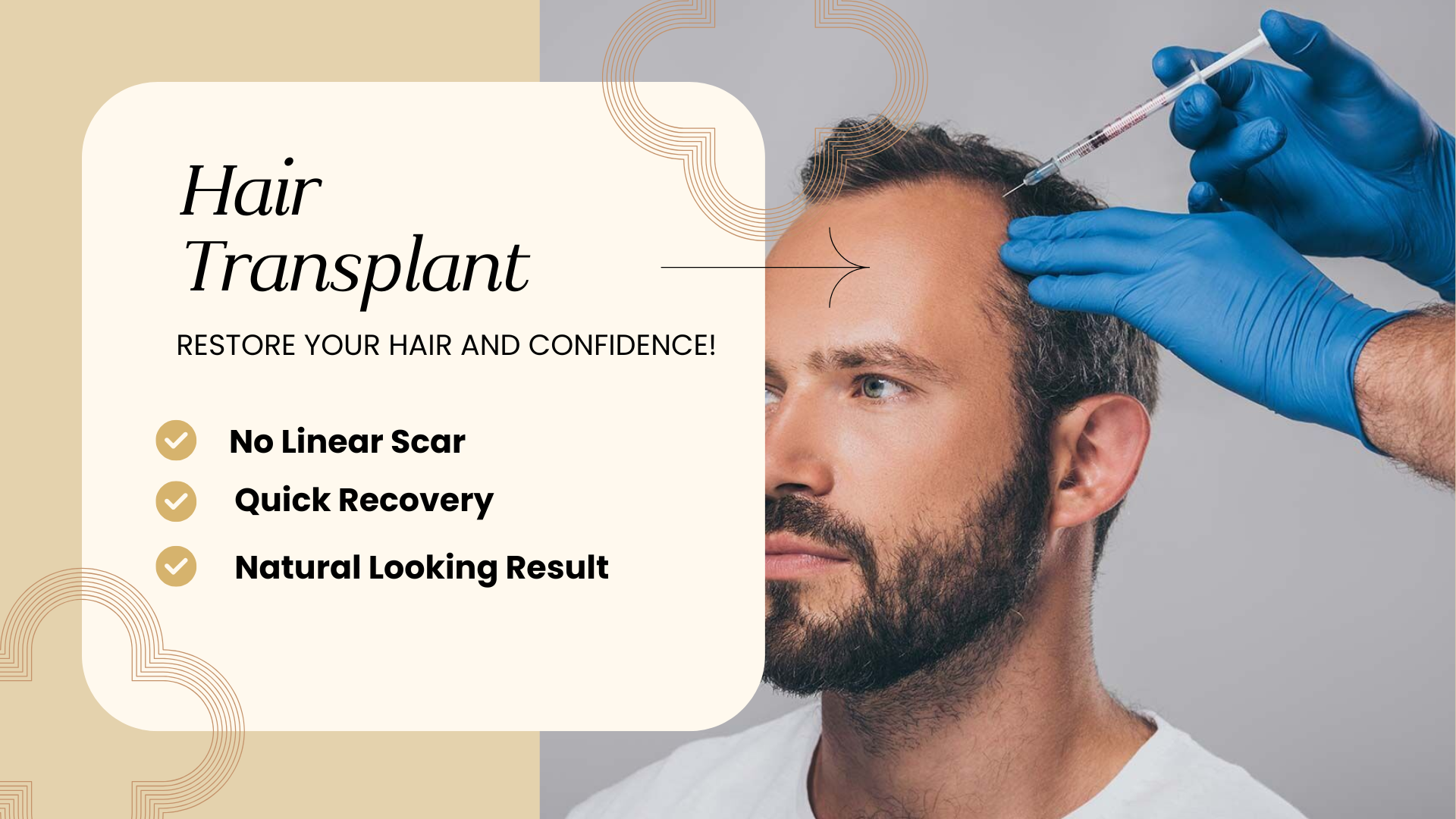 Hair Transplant Surgery: What to Expect Before and After the Procedure