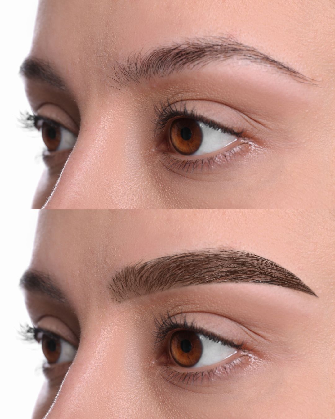 Affordable Eyebrow Restoration Solutions for Stunning and Lasting Outcomes
