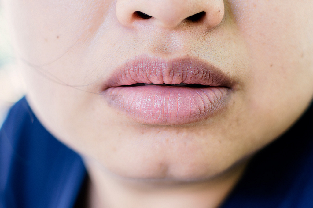 Say Goodbye to Dark Lips: Dark Lips Treatment in Islamabad