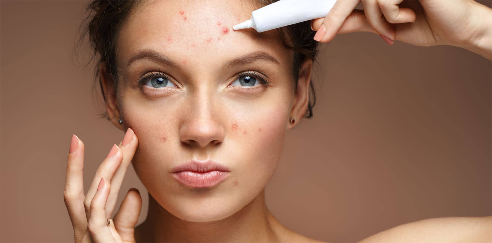 Struggling with Acne? Here’s How a Top Dermatologist Can Help