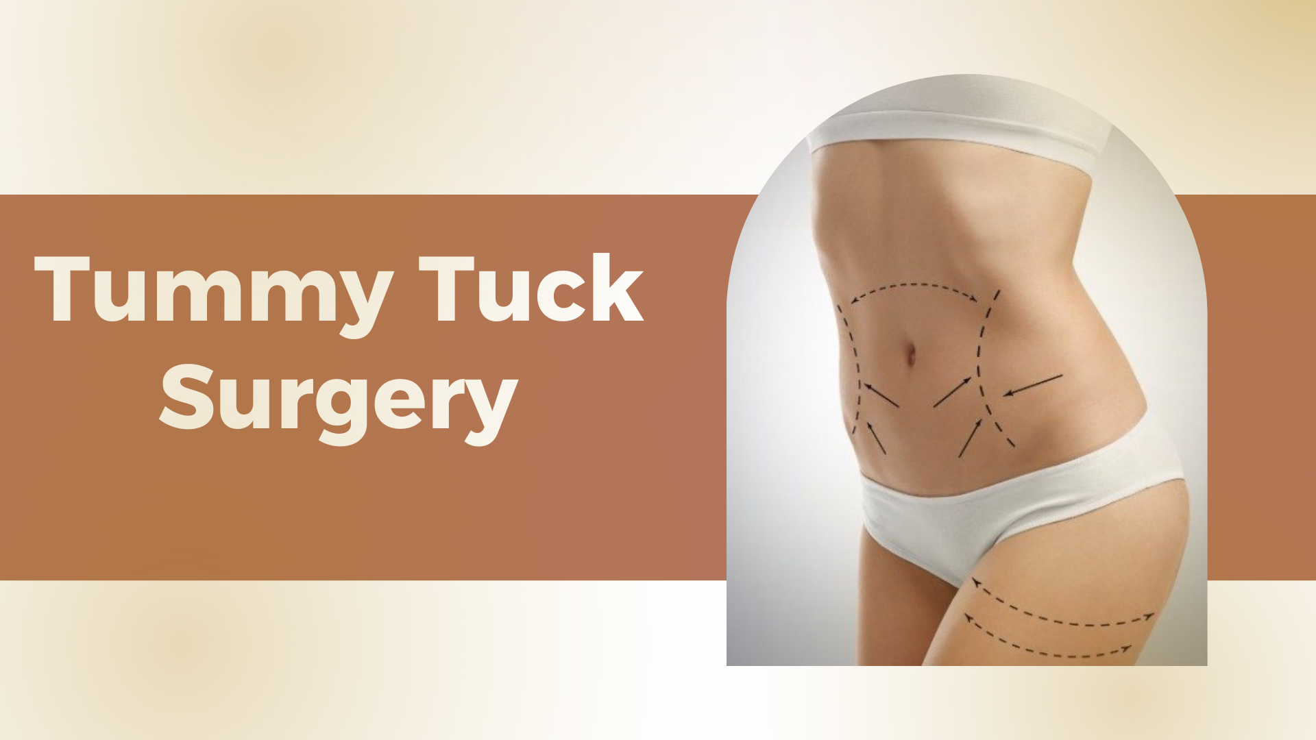 Tummy Tuck Surgery: Procedure, Benefits, and Recovery Guide