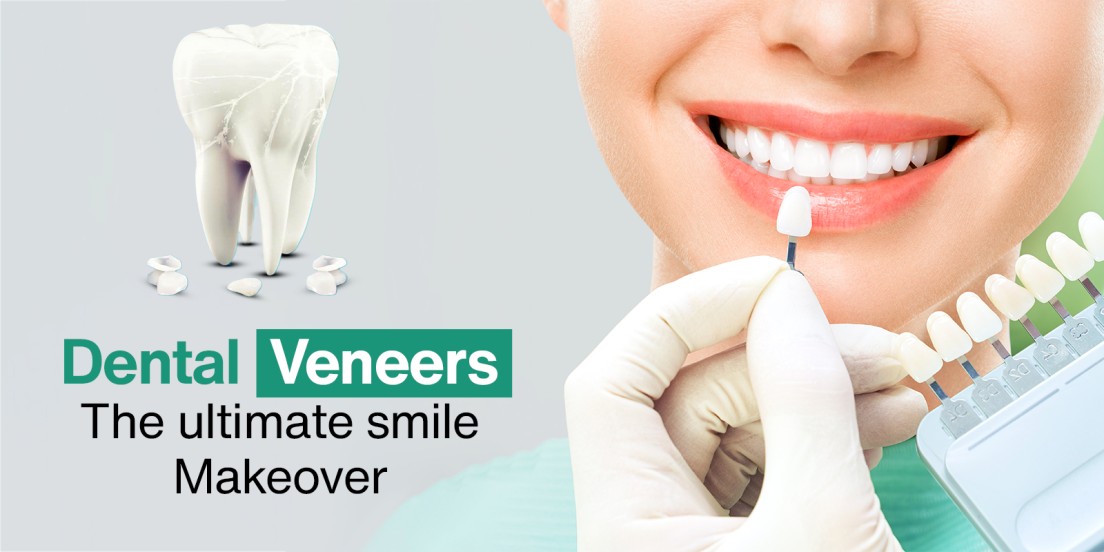Is Dental Veneers Procedure Painful ?