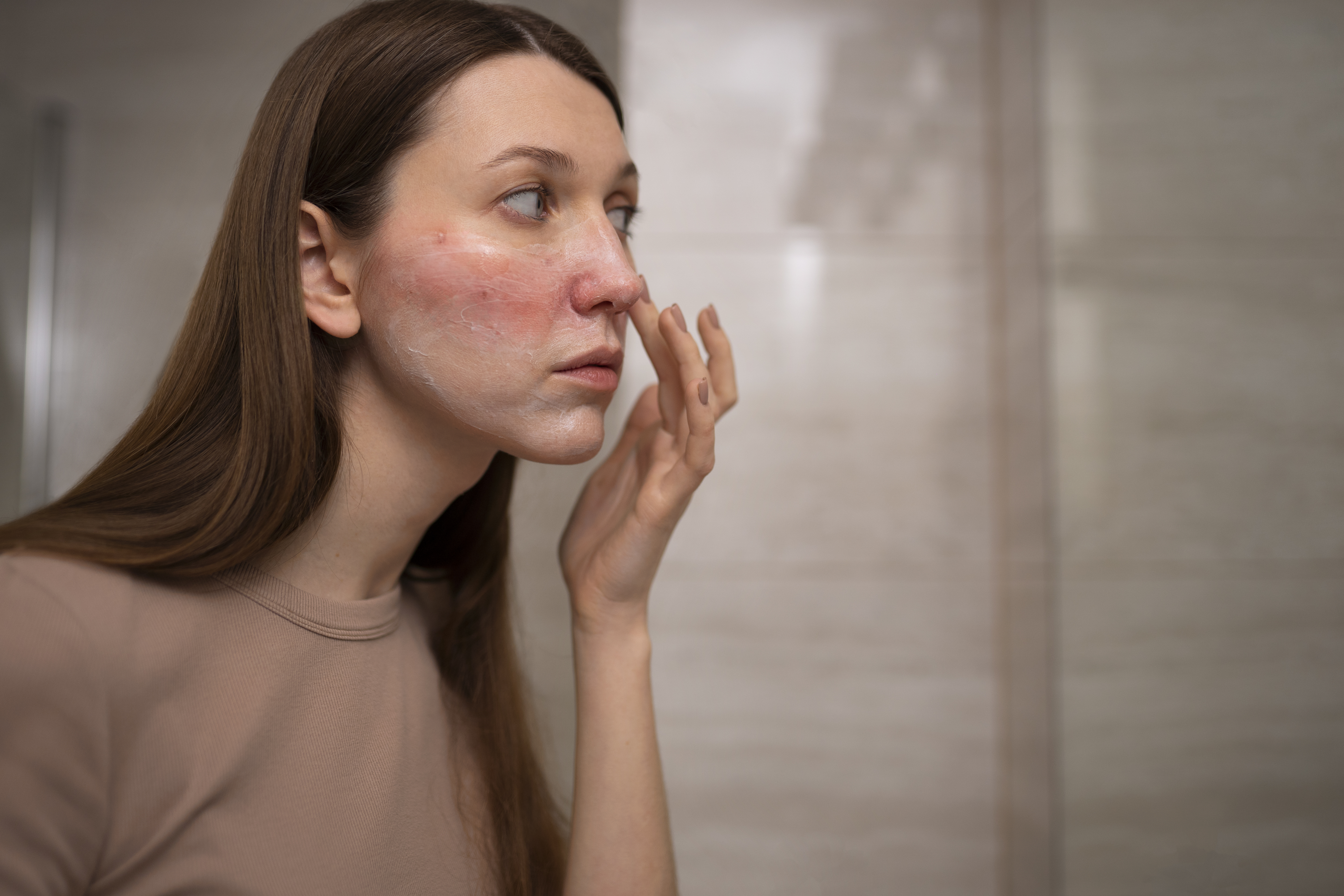 Vascular Lesions on the Face & Body: Causes and Solutions