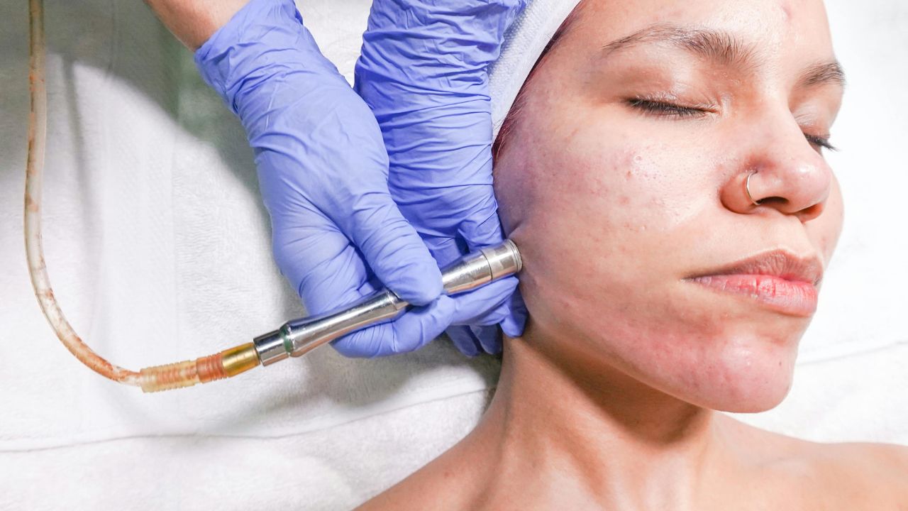 7 Key Benefits of Facial Plastic Surgery Today