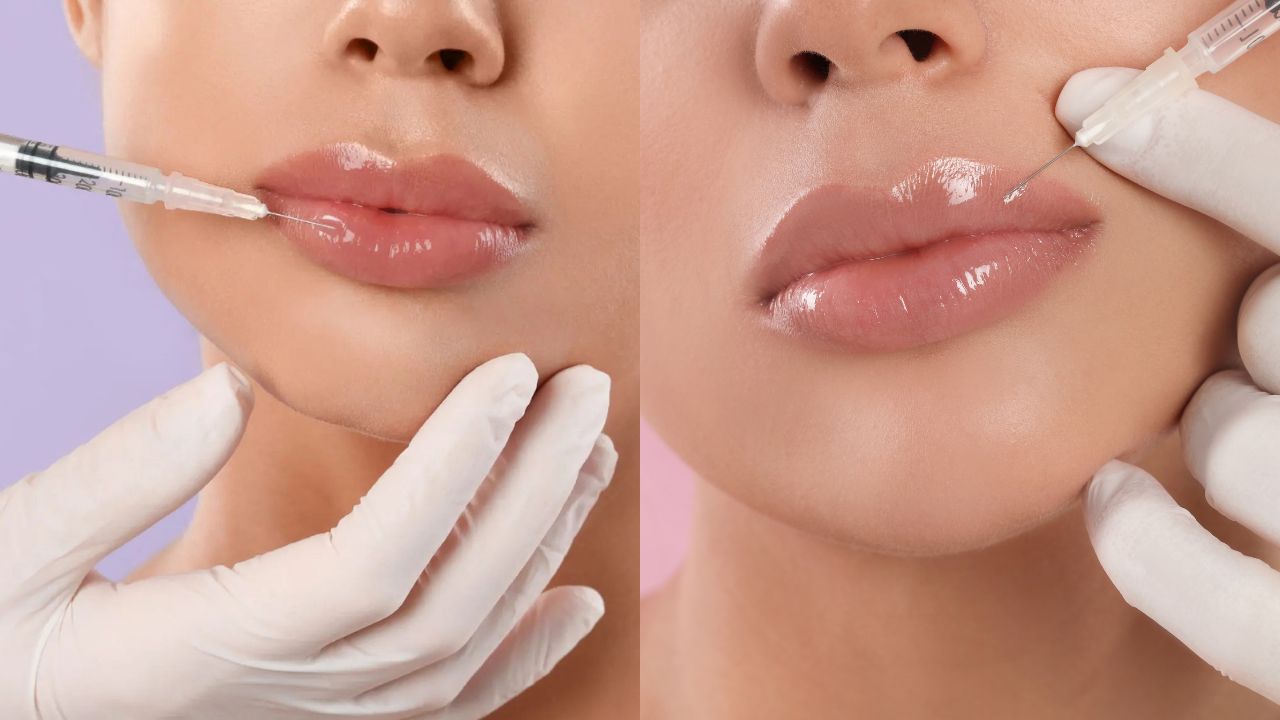 Lip Filler Near Me in Hull