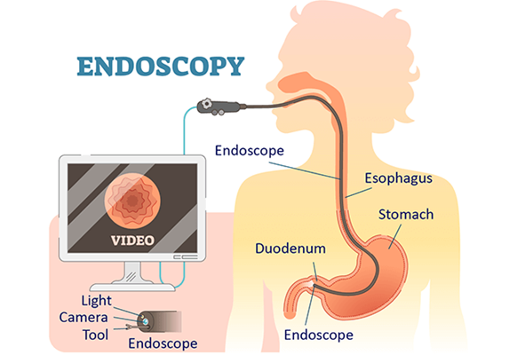 best endoscopy treatment in india - Gastro and liver doctor in mumbai