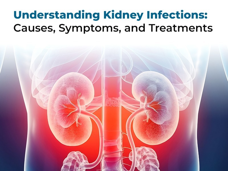 Preventing Kidney Infections: Causes, Symptoms & Treatment Guide