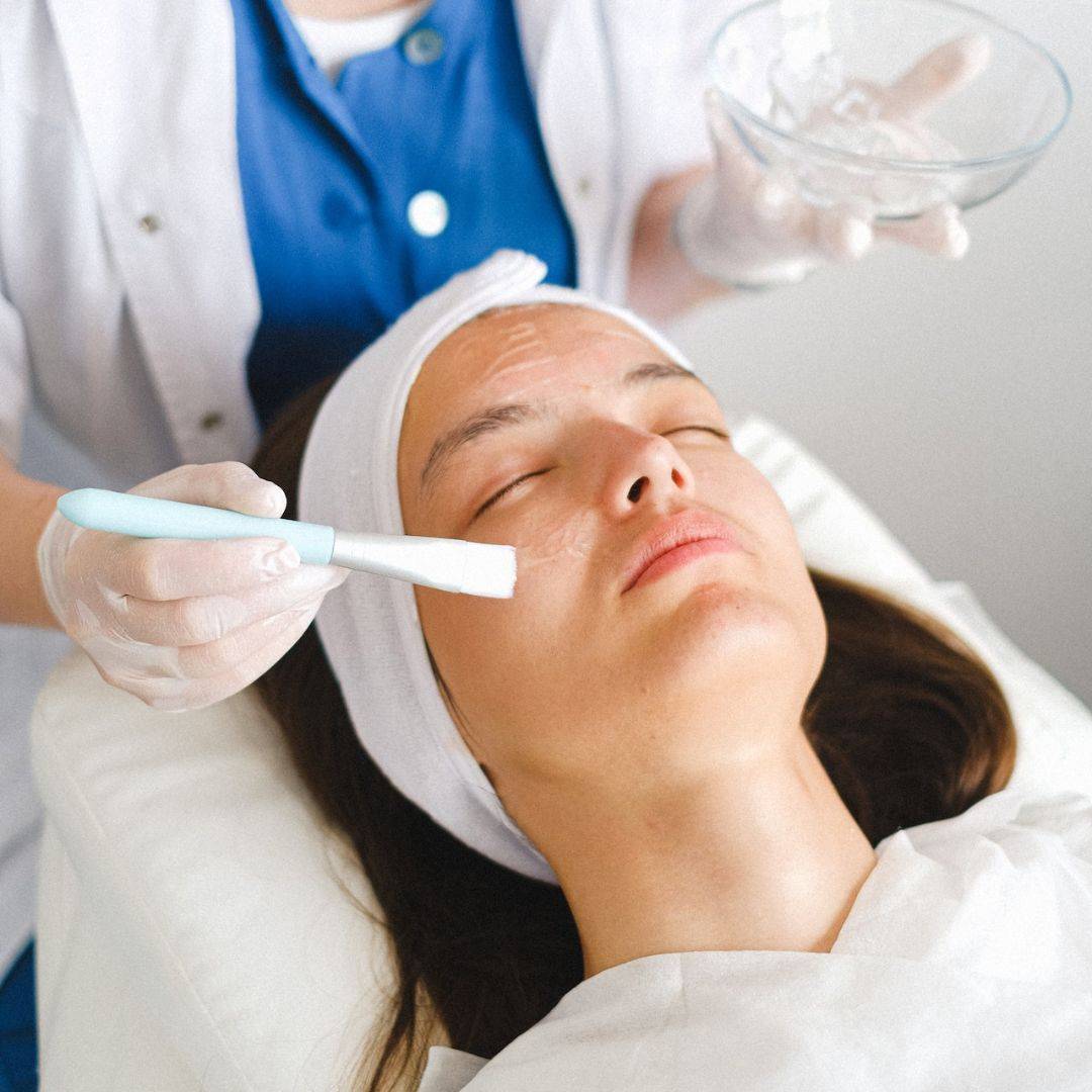 Best Chemical Peel in Queens for Acne and Acne Scars