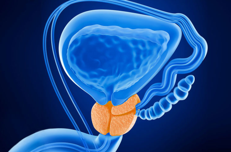 How High-Quality Prostate Cancer Biospecimens Enable Breakthrough Therapies