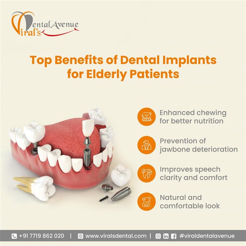 Your Trusted Dental Care Destination in Mulund – Viral Dental Avenue