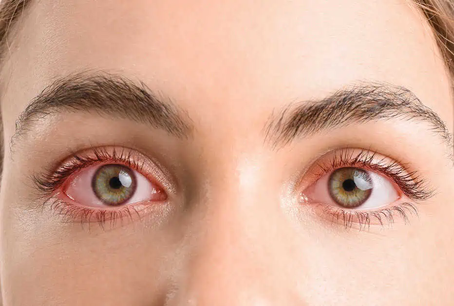 lasik surgery cost in chinchwad