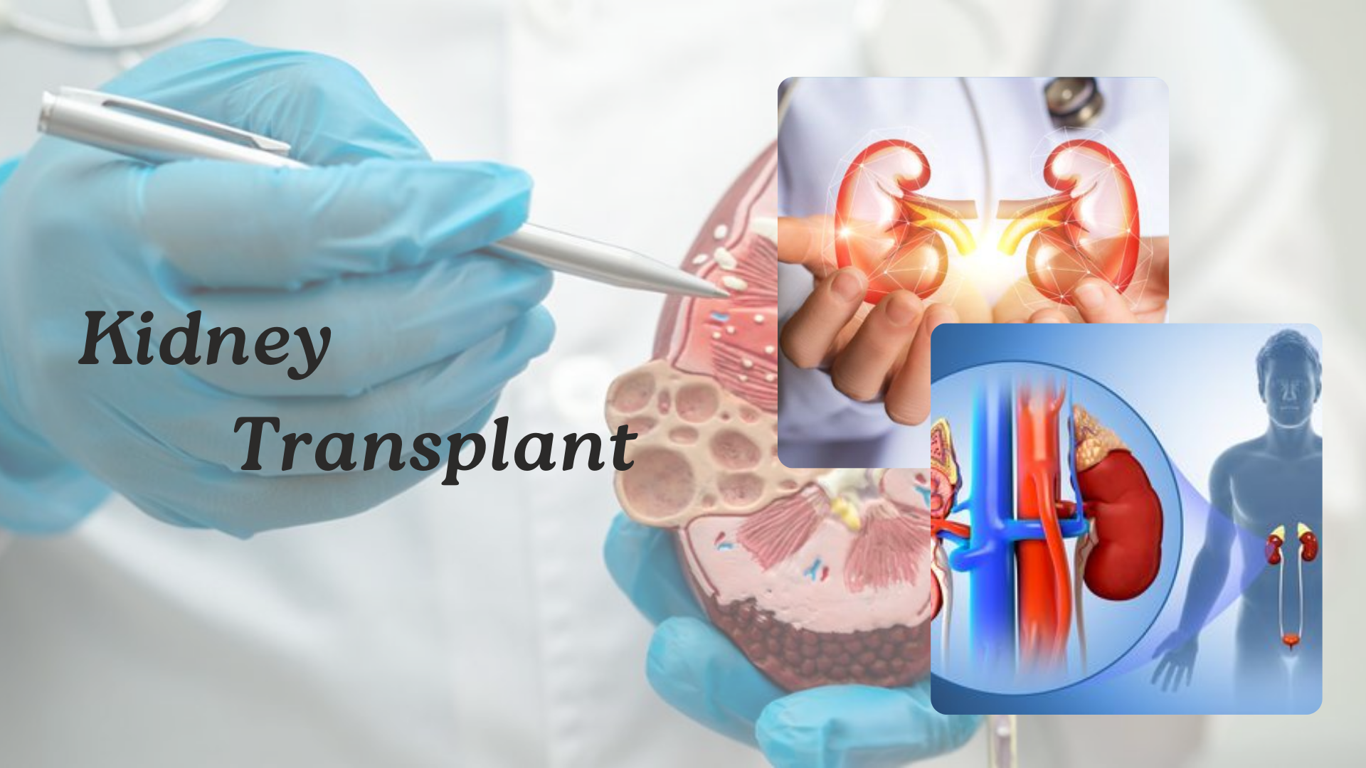 What to Expect from a Kidney Transplant Specialist: A Complete Guide