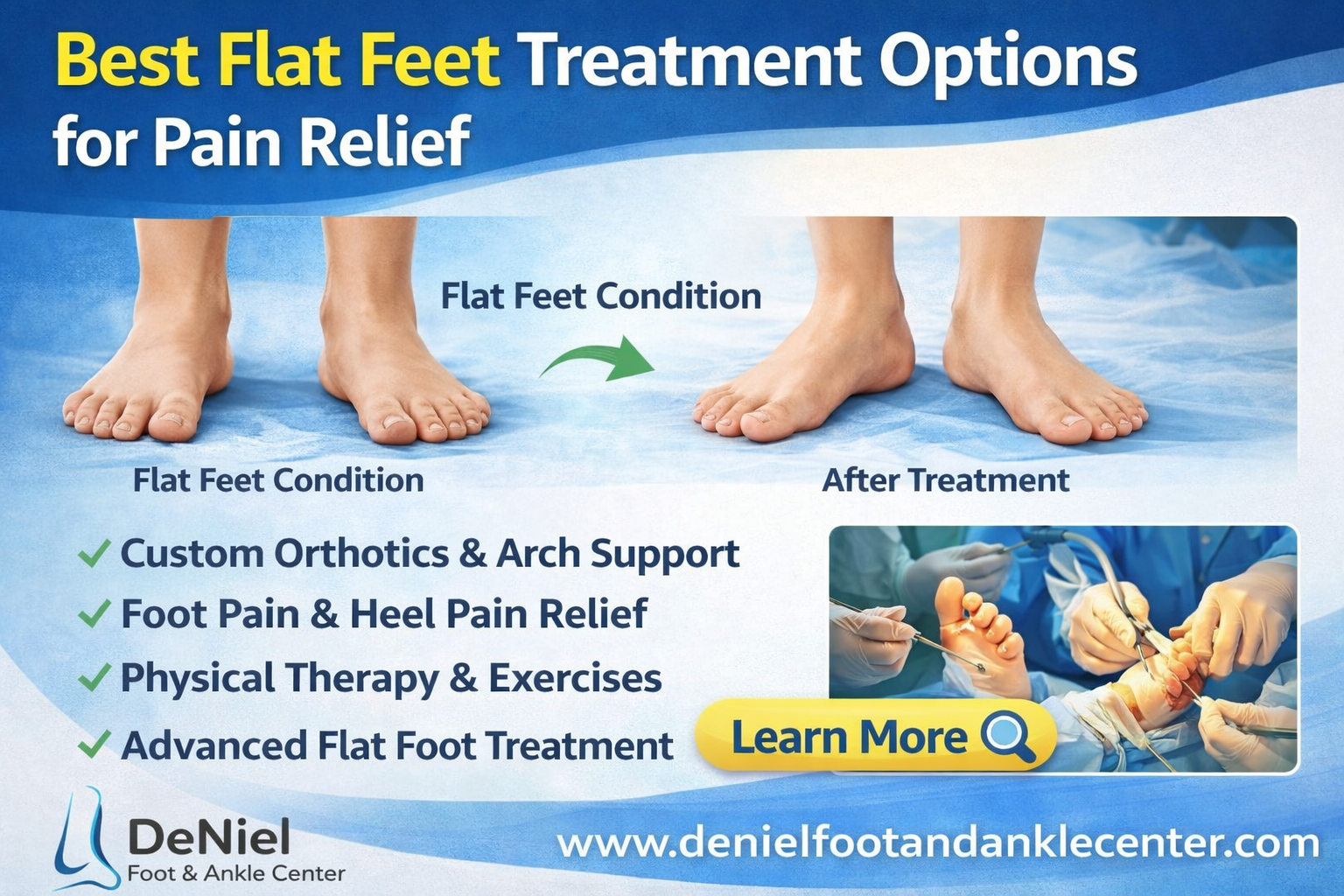 flat feet treatment options