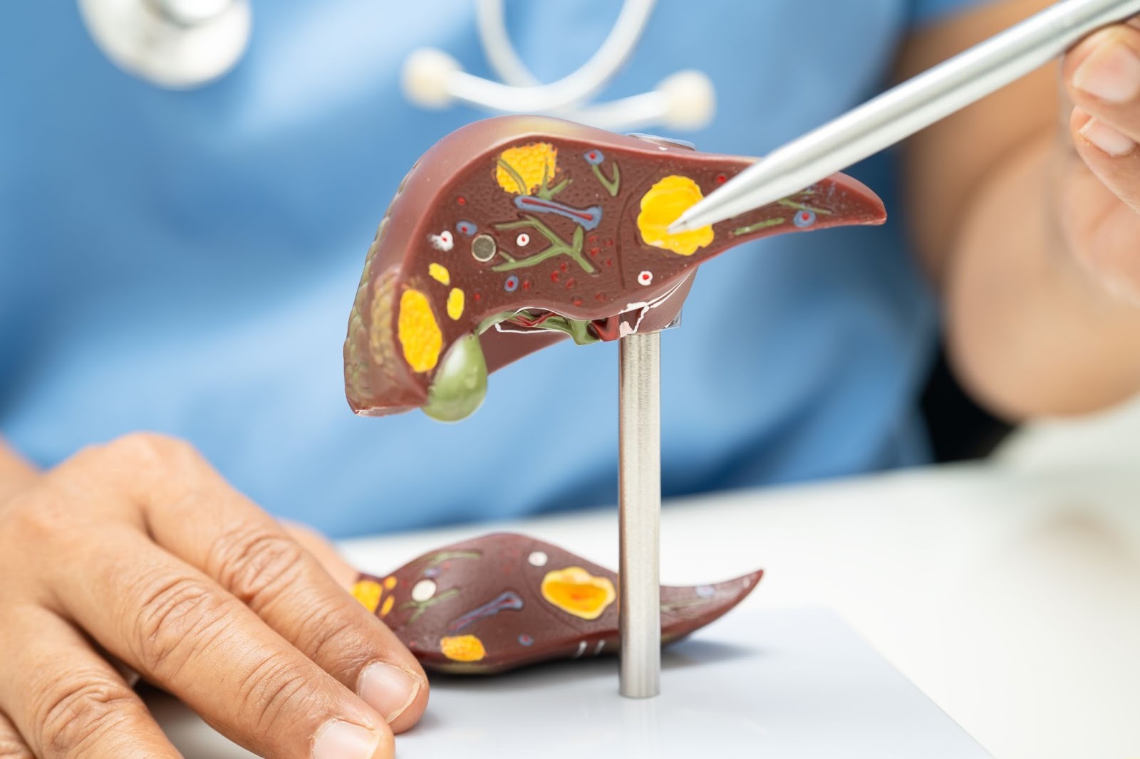 Best Liver Specialist in India: Risks of Untreated Liver Problems