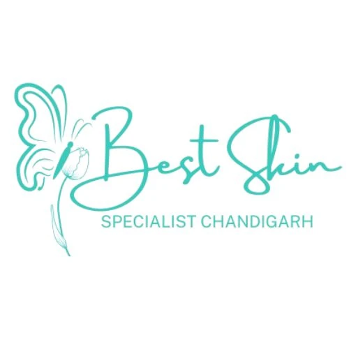 Best Skin Specialist Chandigarh