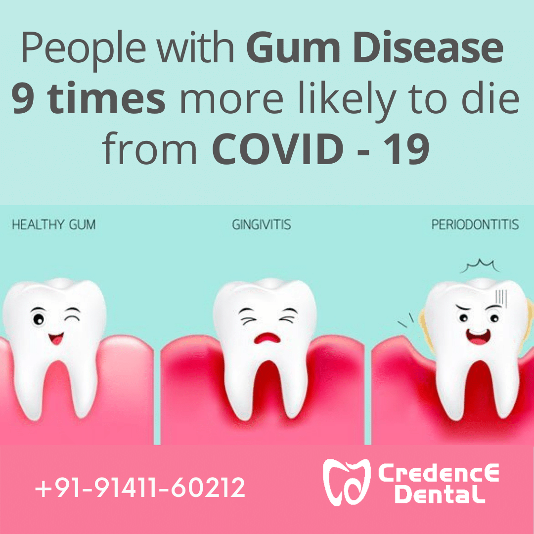 Gum disease-16b5c7b9