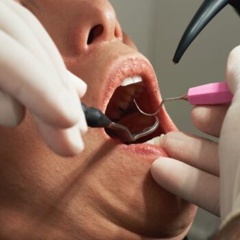 Reduce-dental-anxiety-by-san-diego-periodontics-implant-dentistry-137e353a