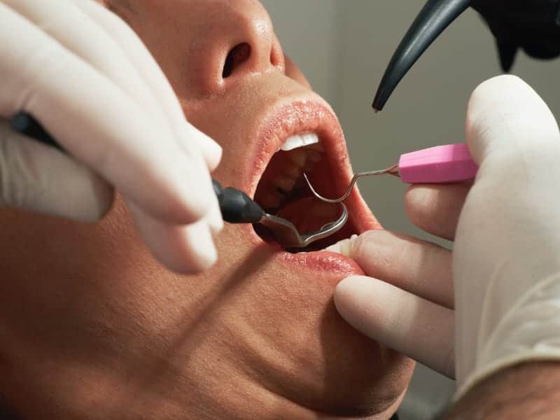 Reduce-dental-anxiety-by-san-diego-periodontics-implant-dentistry-137e353a
