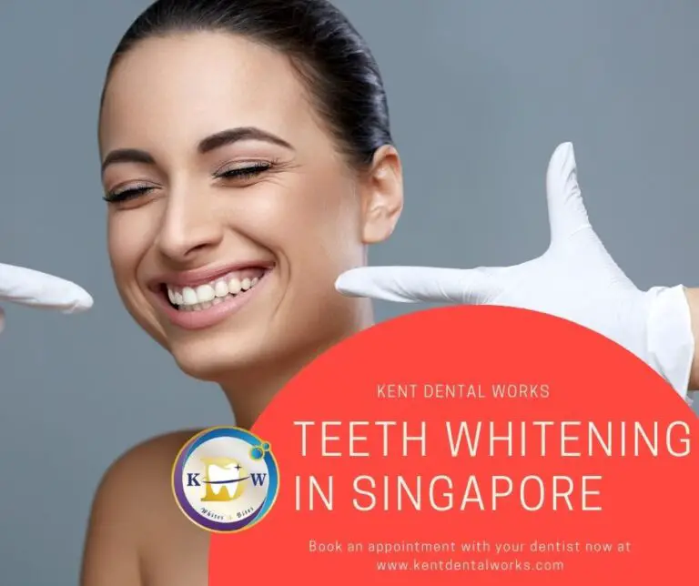 Teeth Whitening Singapore