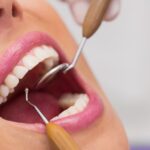 why-shouldn't you delay your dental visit-086c6433
