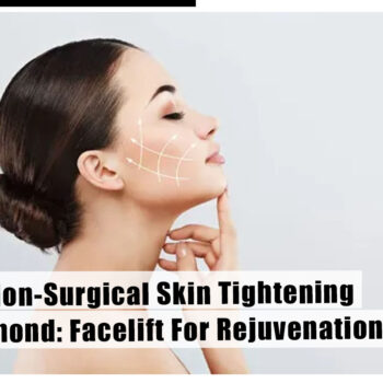 Best Non Surgical Skin Tightening Richmond Facelift For Rejuvenation 2-03a67009