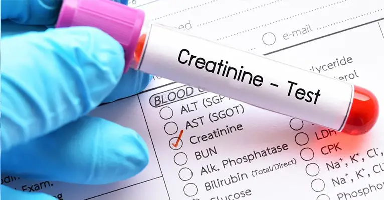 What happens when creatinine is high-e11979ce