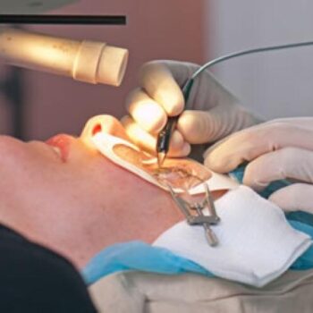 Retina Surgery