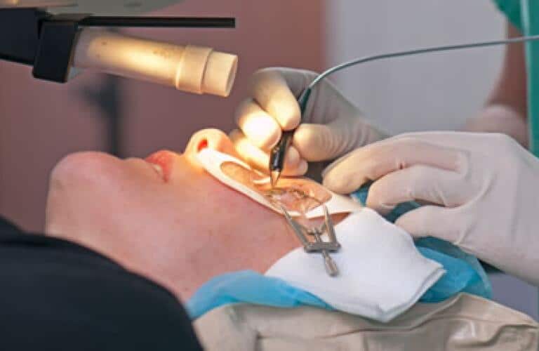 Retina Surgery