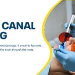 root canals-76293e77